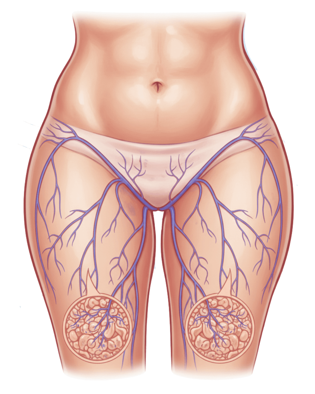 Nutrizione anti-infiammatoria