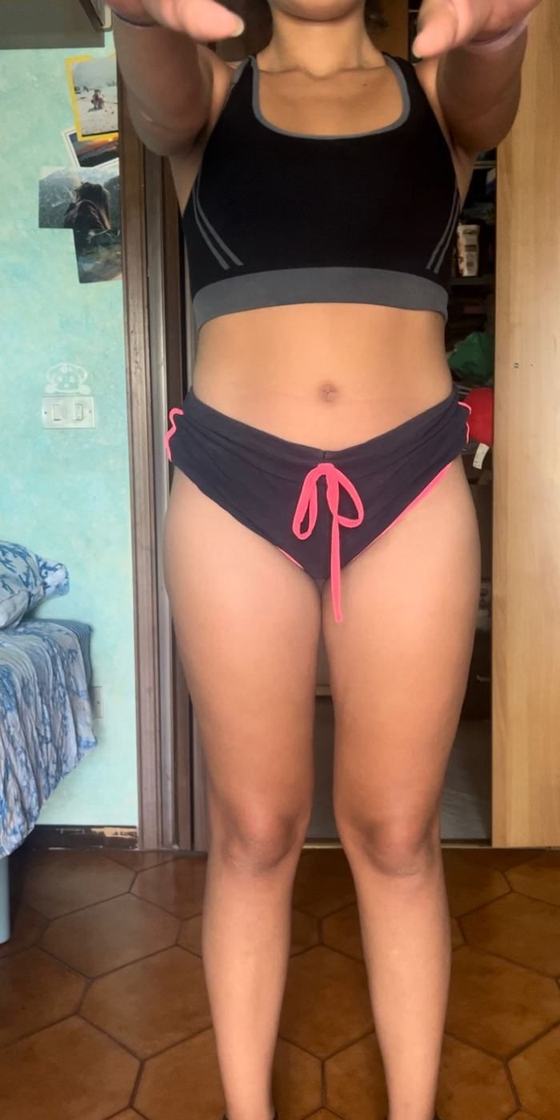 Gambe di Elisabetta dopo il percorso anti-lipedema