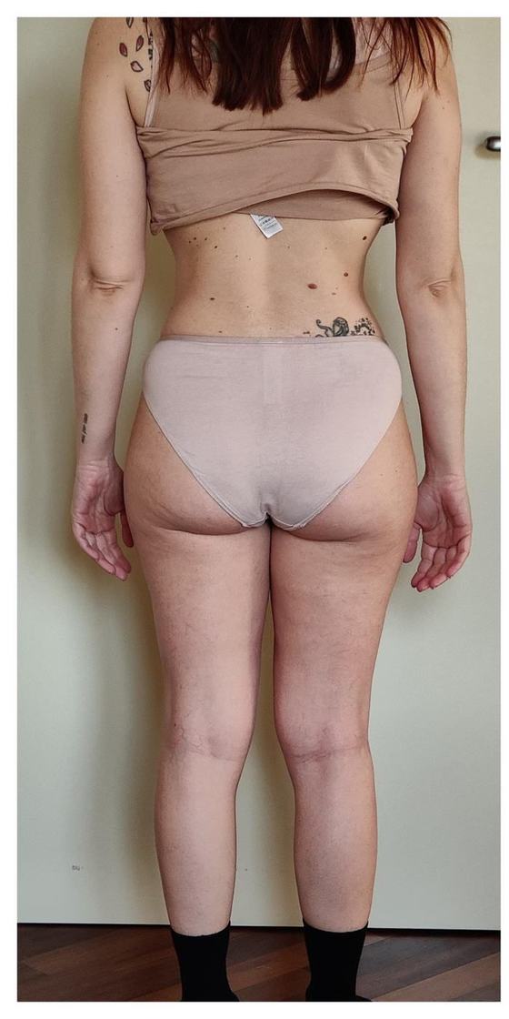 Vanessa, 39 anni prima